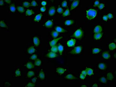 TPT1 Antibody