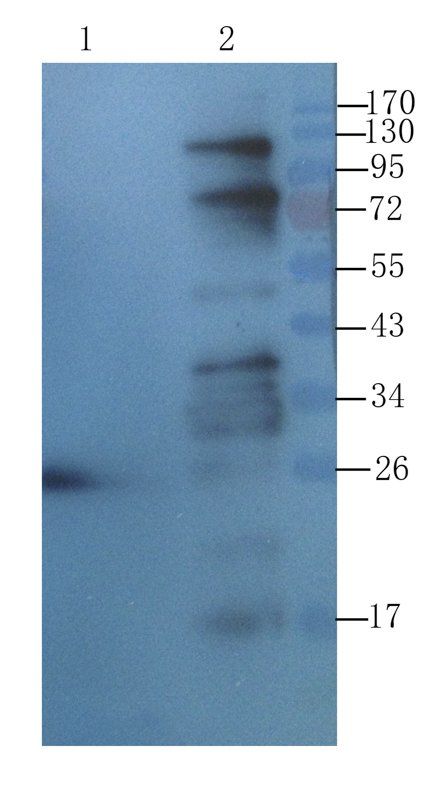Transthyretin Mouse Monoclonal Antibody