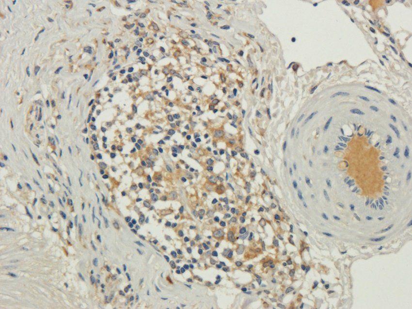 TRAPPC11 Rabbit Polyclonal Antibody