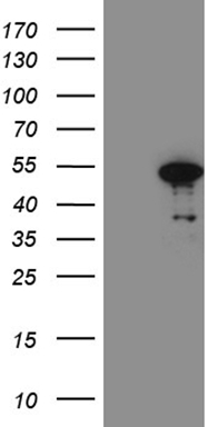 TARBP2 Antibody
