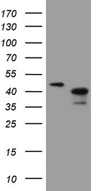 TRIB1 Antibody