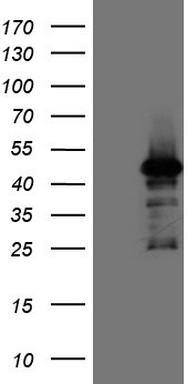 TRIB1 Antibody