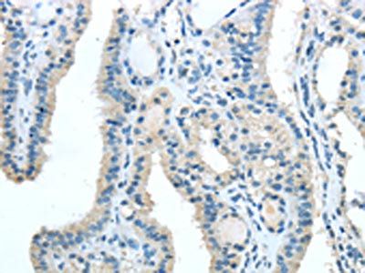 TRIB1 Antibody