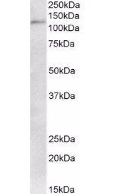 KAP1/TRIM28 Antibody