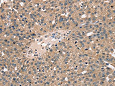 TRIM3 Antibody