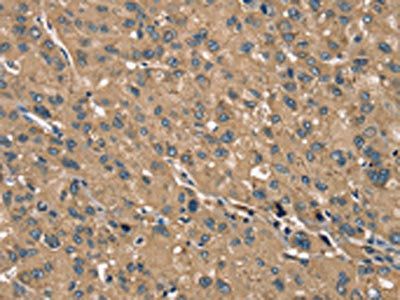 TRIM3 Antibody