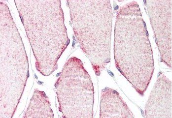 Goat anti-MURF3 / TRIM54 Antibody