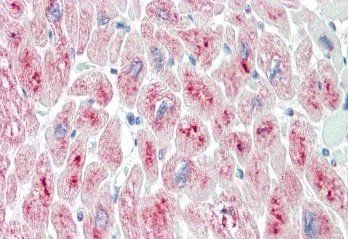 MURF2/TRIM55 Antibody