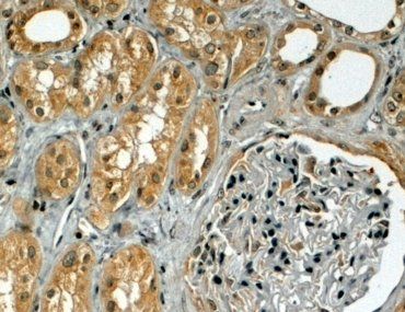 TRIM5/RNF88 (alpha isoform) Antibody