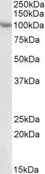 TRIM71 (aa390-402) Antibody