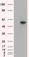 NTRK3 Antibody