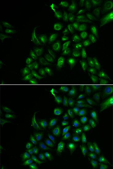 TSPAN7 antibody