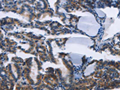 TWF2 Antibody