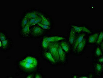 TXK Antibody