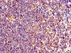 TXK Antibody