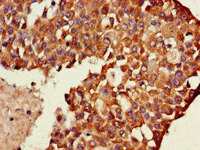 TXK Antibody