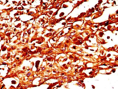 TYR Antibody