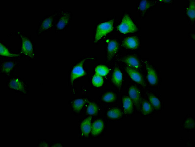 CLIP2 Antibody