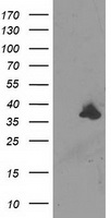 UBA2 Antibody
