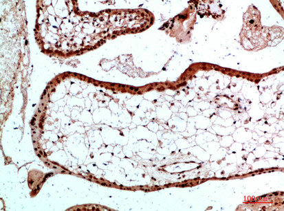 UBB/UBC/RPS27A/UBA52 Antibody