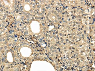 UBE2B Antibody