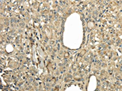 UBE2B Antibody