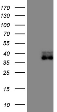 UBE2D2 Antibody