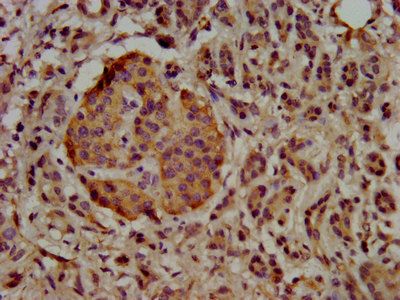 UBE2G1 Antibody