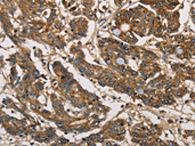 UBE2S Antibody