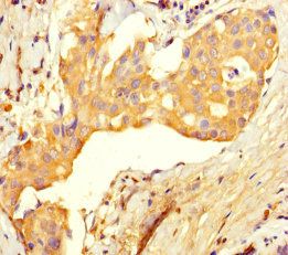 UBE2T Antibody