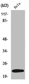 UBE2T Antibody