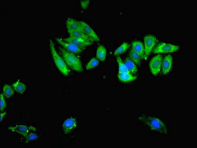 USP14 Antibody