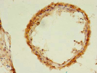 UBLCP1 Antibody