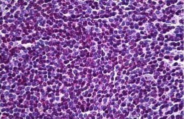 EDD1/HYD Antibody