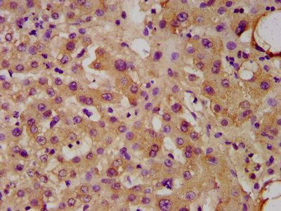 UGT1A1 Antibody