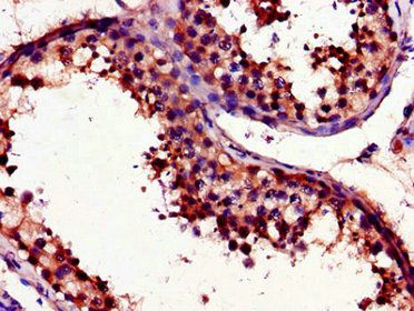 UNG Antibody
