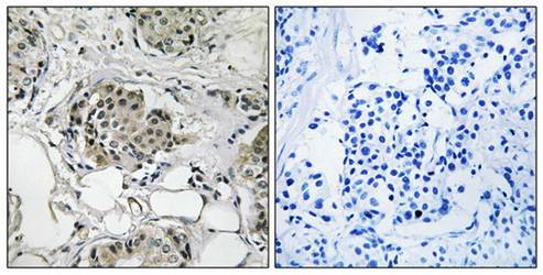 USP13 Antibody