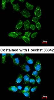 USP15 antibody