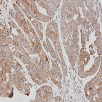 USP15 antibody