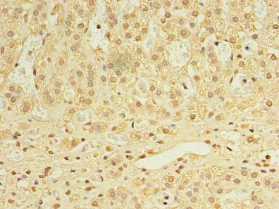 UTP23 Antibody