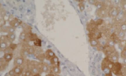 Mouse Human Cytochrome P450 2A6 Antibody