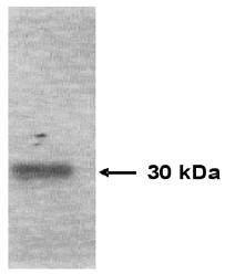Mouse Human Tissue Inhibitor of Matrix Metalloproteinase 1 (TIMP-1) Antibody