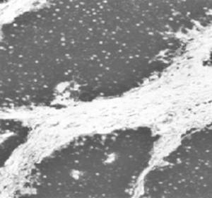 Mouse Human Enolase Antibody