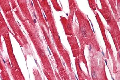 S100A1 antibody