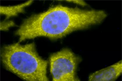 TCP1-alpha antibody